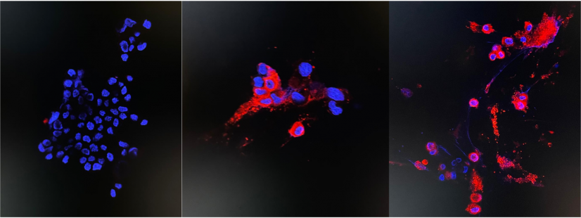 Immunofluorescence staining of uninfected and infected Vero E6 cells
left: Uninfected sample (the negative control)
middle: 24 hours post infection
right: 48 hours post infection (see red fluorescent cytoplasmic antigen staining under confocal microscopy)   
Photo credit: Department of Microbiology, HKU 
 